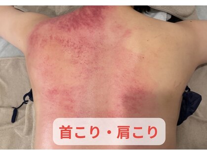 からだ美人 ヘッドスパ 鹿児島の写真