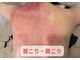 からだ美人 ヘッドスパ 鹿児島の写真