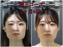 顔と身体の歪み矯正院 吉祥寺の雰囲気（ビフォーアフター）
