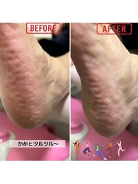 フットケアオプション♪