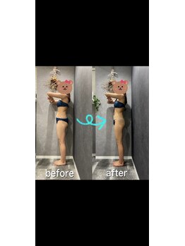 ナナ整骨鍼灸院 ココ(Nana整骨鍼灸院 Coco)/痩身