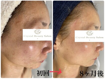 クリスタルビューティーサロン(Crystal Beauty Salon)の写真