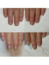 キュア(Cure.)/健康な爪に育む自爪育成の施術