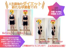 整骨院ひまわり/NEWダイエット実績【-9.45キロ】