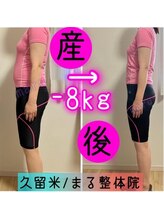 まる整体院/ダイエット症例