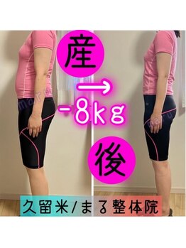 まる整体院/ダイエット症例
