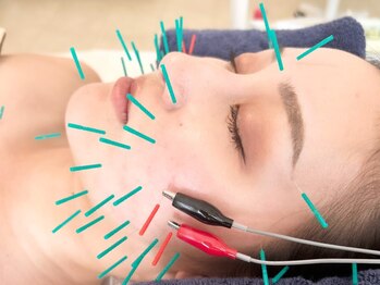 めい鍼灸院の写真/【ハリネズミ美容鍼】メディアで話題の小顔効果抜群の美容鍼♪むくみ解消にも◎芸能人にも人気の美容施術♪