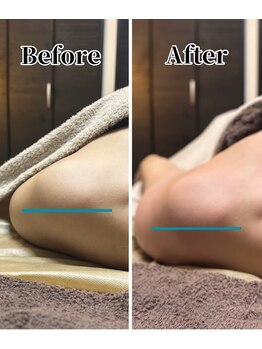 フィール(feel)/整体+リンパ Before & After