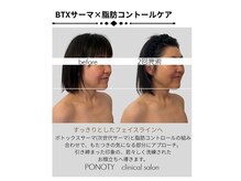 ポノティー(PONOTY)/次世代サーマ×脂肪コントロール