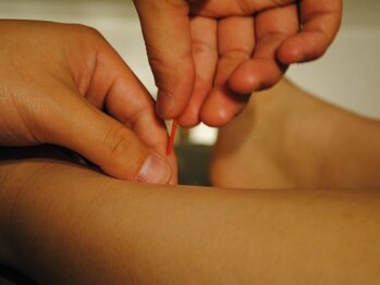 ひとはり/全身鍼灸