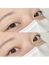 レジアント(Rediant)/パリジェンヌラッシュリフト