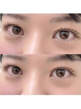 ソポ(sopo)/上下まつ毛パーマ
