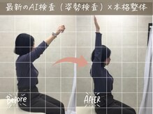 ナオル整体 荻窪院(NAORU整体)/before/after【2】荻窪/整体