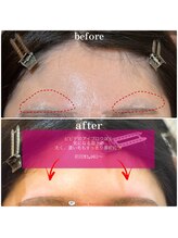 ビビデバビデ(Vivide Vavide)/眉毛サロンで埋もれ毛解消☆彡