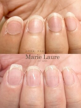 マリーロール 淀屋橋本店(Marie Laure)/自爪育成/深爪矯正/ネイルケア