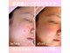 サロンドミミ(Salon de Mimi)の写真