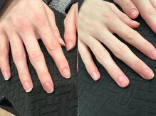 ディーディー(DxD)/ネイルケア