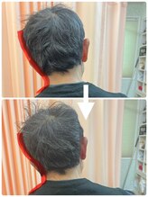 しもえのお整骨院/首がまわらない！