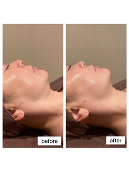 ビンナ(BINNA)/ビフォーアフター　レモンボトル