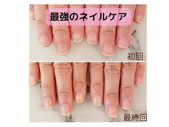 最強のネイルケア　地爪育成