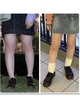 サロンココ(salon koko)/結果を出す施術