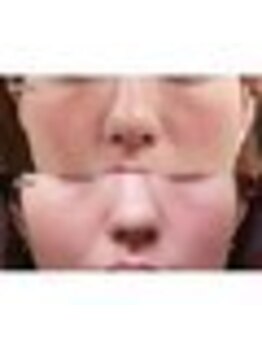 ライゼ(REISE)/メイクブース[小顔／シワ/美白]