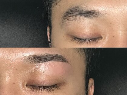 ロバスト(ROBUST)の写真