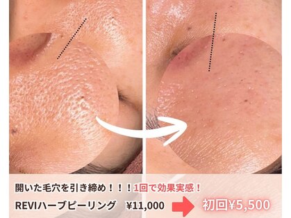 アクシア ビューティー サロン(AXSIA)の写真