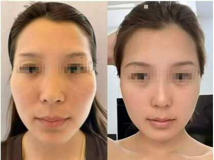 美 ラインの写真