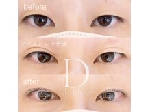 サロンドルシエ(salon de Lucie)の雰囲気(まぶたの一重・奥二重のお悩みに◎【ダブルアイリフト】)