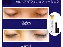 シストワ(sistoi)/★ぐんぐん伸びるまつ毛★