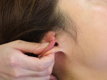 リバイブ 五反田店(REVIVE)/ドライへッドスパ頭蓋骨小顔矯正