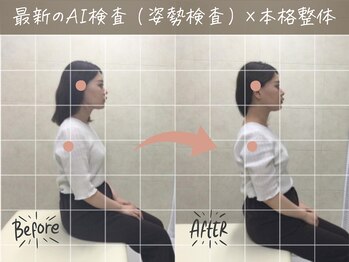 ナオル整体 荻窪院(NAORU整体)/before/after【3】荻窪/整体