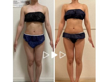 ヨサパーク レオ 籠原(YOSA PARK Rheo)