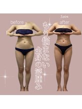 ソワン(Soin)/アーユルヴェーダ