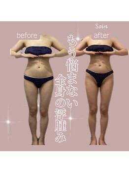 ソワン(Soin)/アーユルヴェーダ