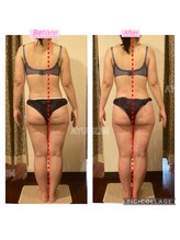 アユスリム(AYU SLIM)/歪み改善　施術一回での効果!