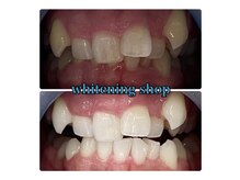 ホワイトニングショップ 高松瓦町店/ホワイトニング専門店高松