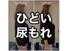 カワル整体 上通り院/諦めていませんか？