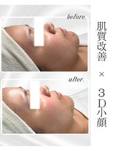 リアム(LiAm)/ララピール×レモンボトル