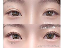 ディッチャ(Dicha)/◇ラッシュリフト◇