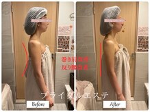 リノ(Lino)/ブライダルエステ