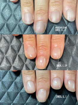 クーラ アンド ベリッシモ(Cura&Bellissimo)/理想の縦長爪