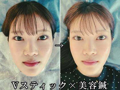 アオヤマ サロン ワイゼット(AOYAMA SALON YZ)の写真