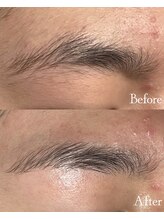 ロイヤルキューティー 介正鍼灸整骨院 コマーシャルモール博多(ROYAL QT)/眉アイブロウWAX脱毛