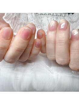 ミソネイル(miso nail)/チークネイル