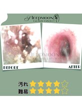 スリープムーン(Sleep MOON)/