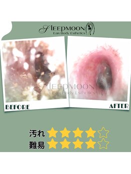 スリープムーン(Sleep MOON)/