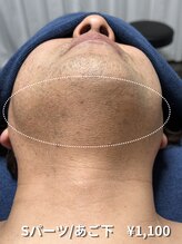 カナウ(KANAU)/【Sパーツ/脱毛】あご下