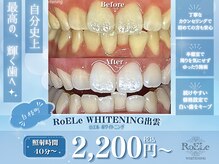 RoELeホワイトニング出雲【7月25日 OPEN(予定)】
